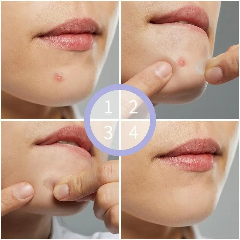 Wild  Invisible Acne Patch